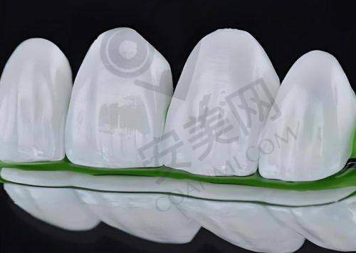 牙齿贴面美白前需要做哪些检查？