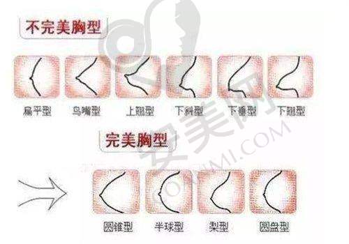 总结