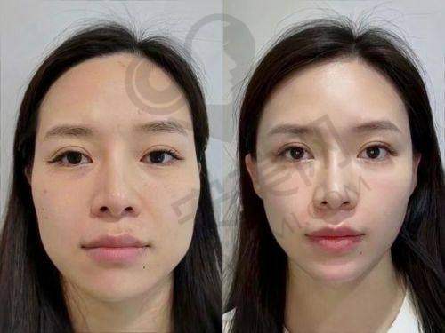 如何预约王志坚医生做提升紧致？