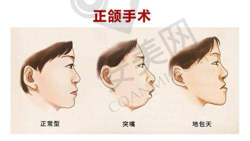 北京联合丽格的医生团队在面部轮廓整形方面水平如何？
