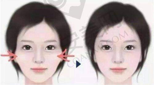 成都棕南私密整形医院正规吗？