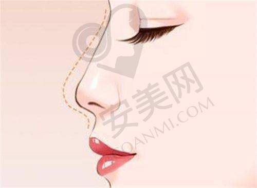 英伦大提升项目到底是什么？有哪些独特之处？
