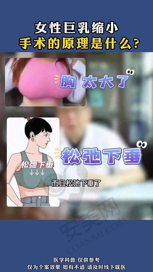 重庆松山医院巨乳缩小技术有什么特色？