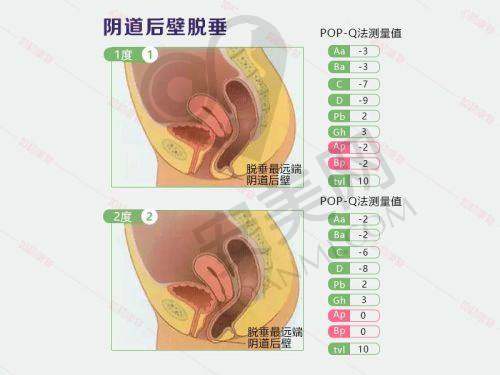 四川省人民医院 - 整形外科：科技助力，微创领航