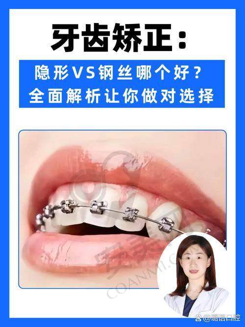 国产金属自锁矫正的价格是如何确定的？
