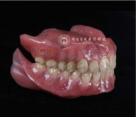 达州医附大口腔BPS全口吸附性义齿的制作流程是怎样的？
