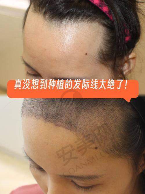北京中德毛发移植医院的就诊初体验如何？