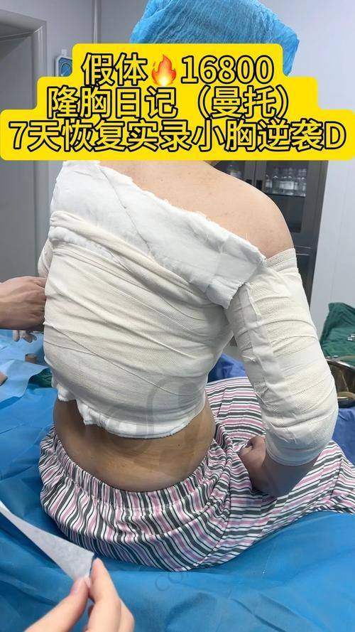 3、杭州瑞丽宋建良医生整形技术怎么样？