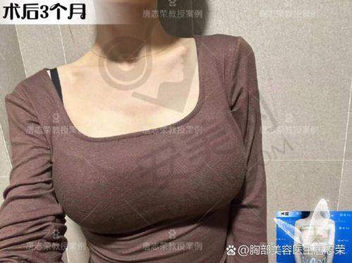 2、太原丽都王新灿医生擅长项目