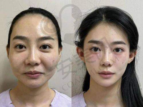 患者对王志坚医生做提升紧致的评价如何？