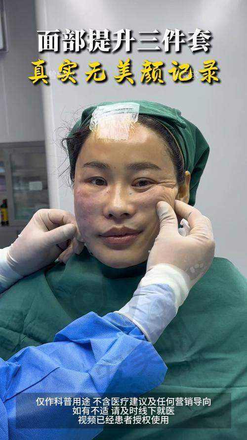 王志坚医生做提升紧致的技术有哪些特点？
