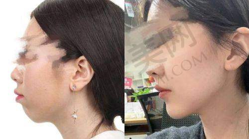 石家庄美莱医疗美容整形医院的医生团队水平怎样？