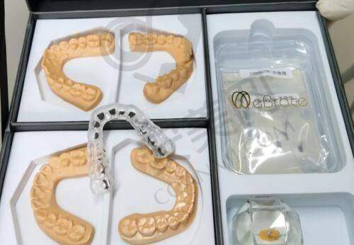成都大麦植发医院的收费合理吗？