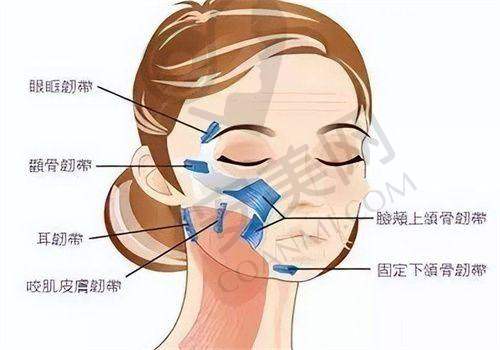 如何选择适合自己的面部提升方式？