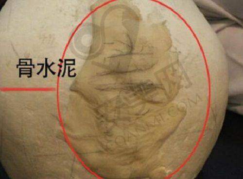 3、濮阳李伟医美医生李世卫整形技术怎么样？