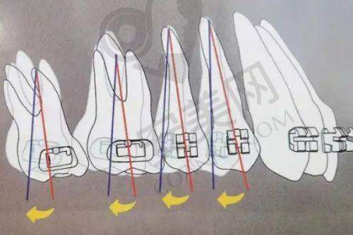 矫正过程：每一步的体验与变化