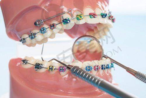 福州维乐口腔补牙、拔牙、洗牙等常见项目收费贵不贵？
