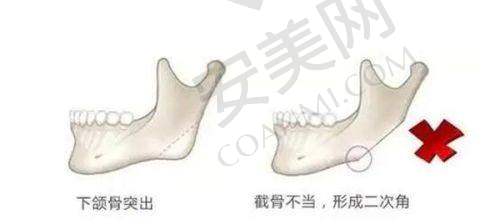 南宁华美整形和美立方的项目价格如何对比？