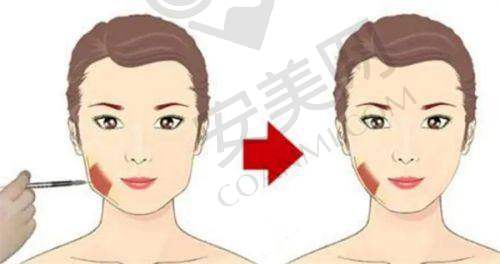 北京晶美整形的医生团队实力如何？