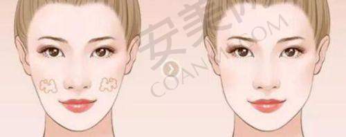 术后的修复情况如何？