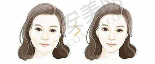 北京艺星打除皱针，医院环境如何？