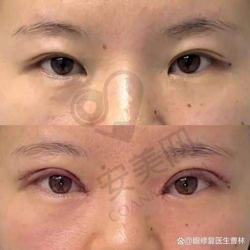 治疗过程：真实感受大揭秘