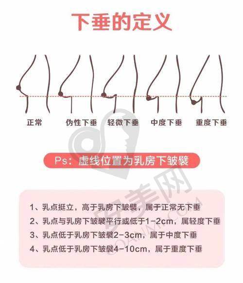 五、选择杭州格莱美隆胸的优势与注意事项