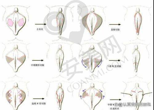 广州建国医院私密整形中 心的环境设施怎么样？