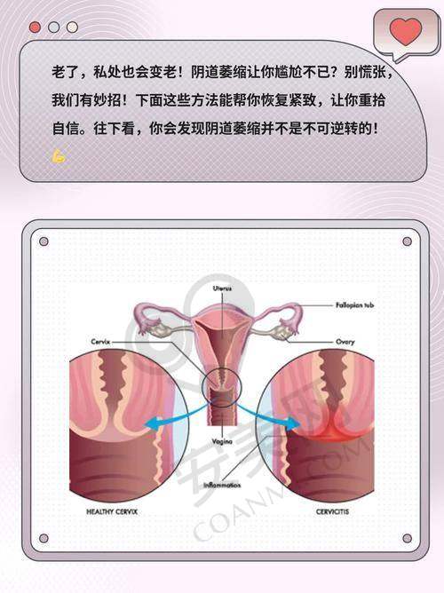 如何选择适合自己的阴道紧缩术方案？