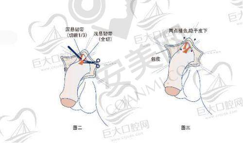 术后修复：悉心照料与逐渐好转