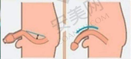2、广州建国王文卫医生擅长项目：