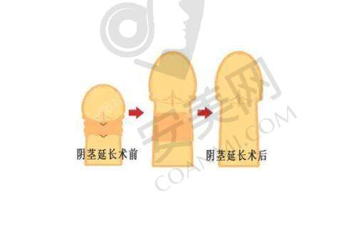 手术过程：紧张但安心