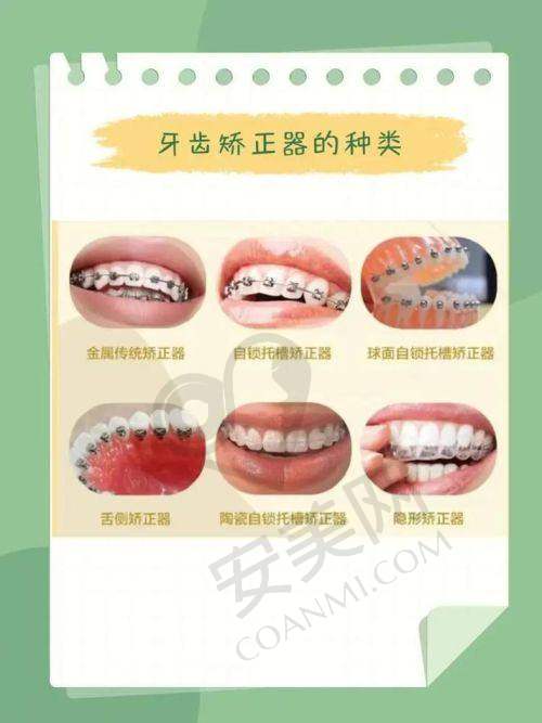 6、昆明尚爱韩美口腔朱芳芳医生预约挂号指南