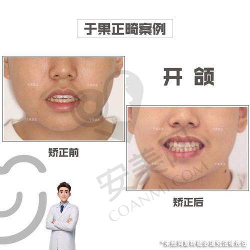 5、昆明尚爱韩美口腔朱芳芳医生患者评价