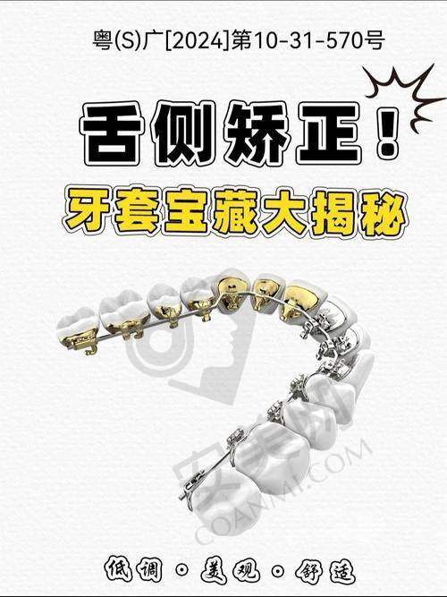 舌侧矫正的过程是怎样的？