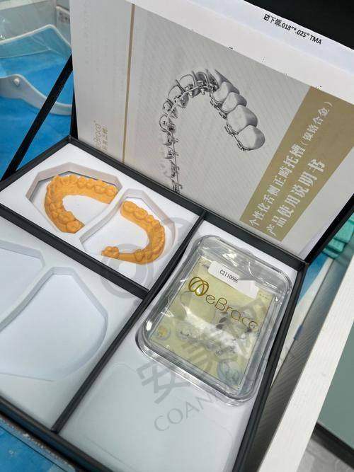 舌侧矫正的优势有哪些？