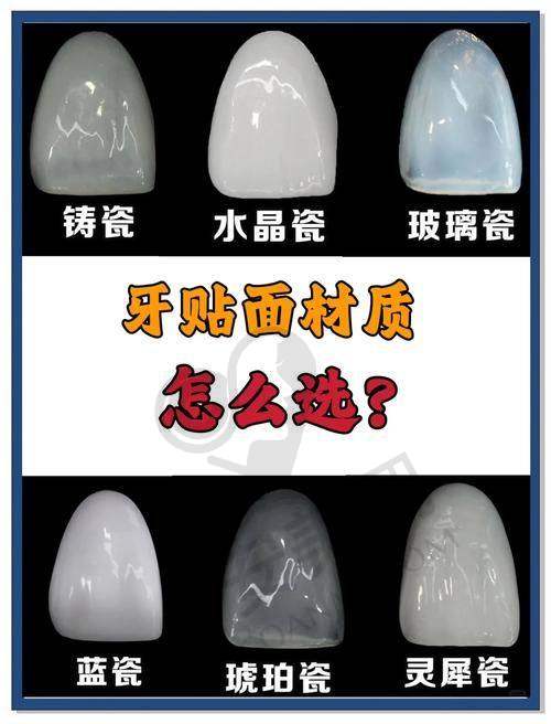 宝鸡团圆口腔医院牙齿贴面美白技术有什么特色？