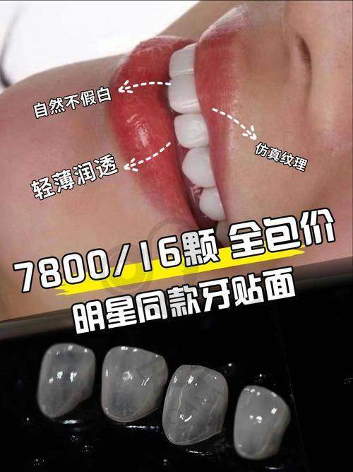 总结：宝鸡团圆口腔医院牙齿贴面美白值得尝试吗？