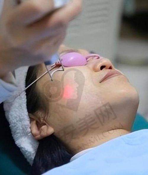 皮秒祛斑价格为何如此诱人？