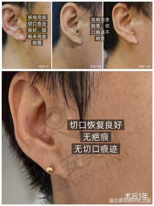适用人群：谁更适合这项技术