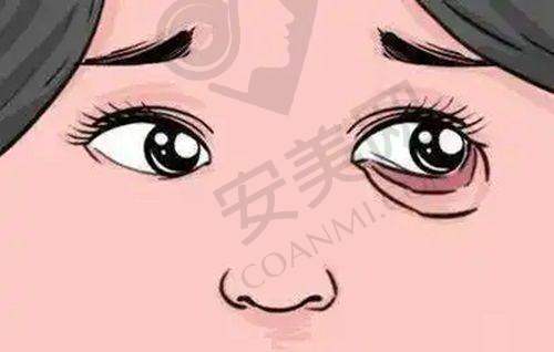 鼻部整形——塑造立体五官
