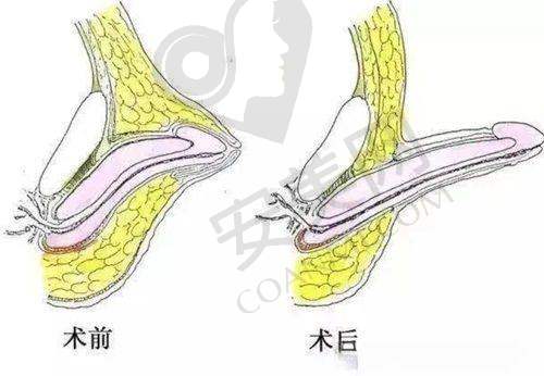 如何预约王文卫医生的男性私密手术？