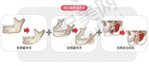 上海爱尚丽格眼修复的技术水平怎么样？