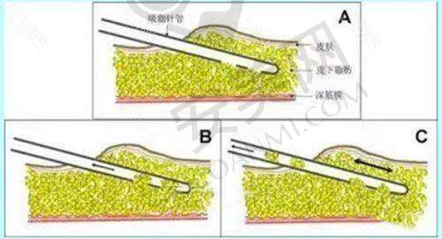 院长的专精领域有哪些？