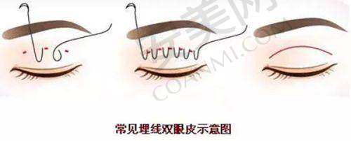 上海爱尚丽格眼修复的口碑评价如何？