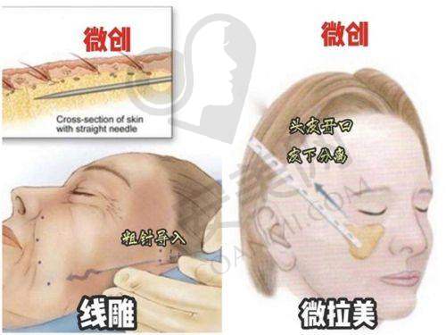 钦州华美医疗美容在行业内的地位如何？