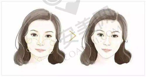 北京纯脂医疗美容和嘉禾的服务质量哪个更好？