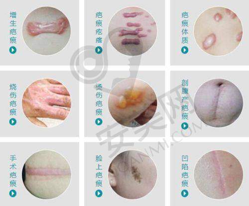 西 南医院整形科：学霸医院的整形实力