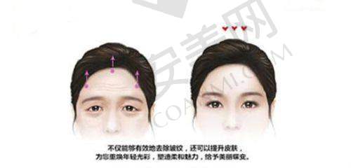 重庆美禅整形医疗整形美容医院：高端定制的美丽之旅