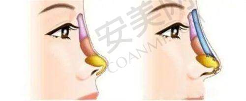 上海首尔丽格整形医院的口碑好不好？